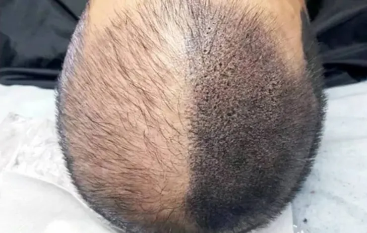 （圖／彤妍魔術紋髮）