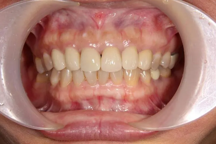 這是2021的，一樣自然好看