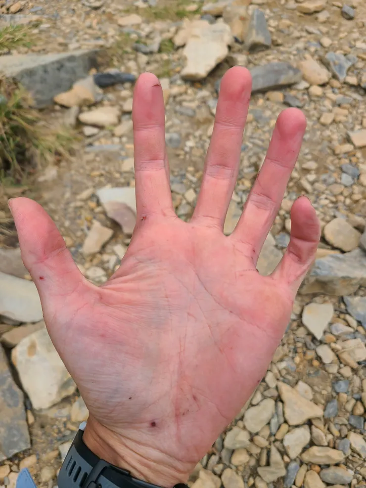 多少有些刮傷都很正常，我不喜歡戴手套