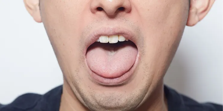 嘴凸、暴牙、深咬讓臉型不好看?森釉牙醫客製矯正,打造自信美!