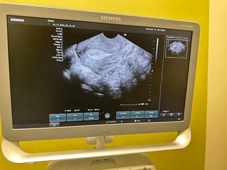 傳說中的黃金三條線，寶寶的豪宅