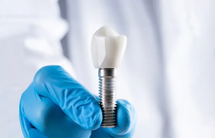 深圳牙科資訊請聯絡：+852 9517 2998！