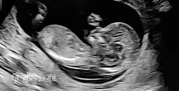 高層次超音波照