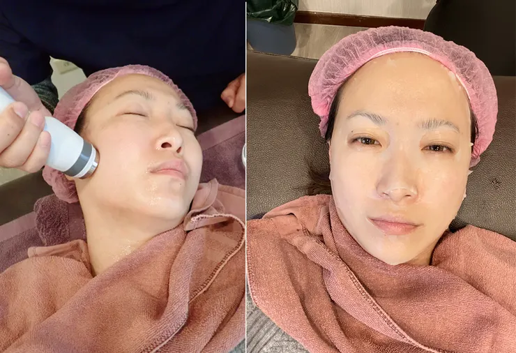 台北打雙下巴│ONDA超微波（昂達），台北醫美診所推薦【旭彤診所】