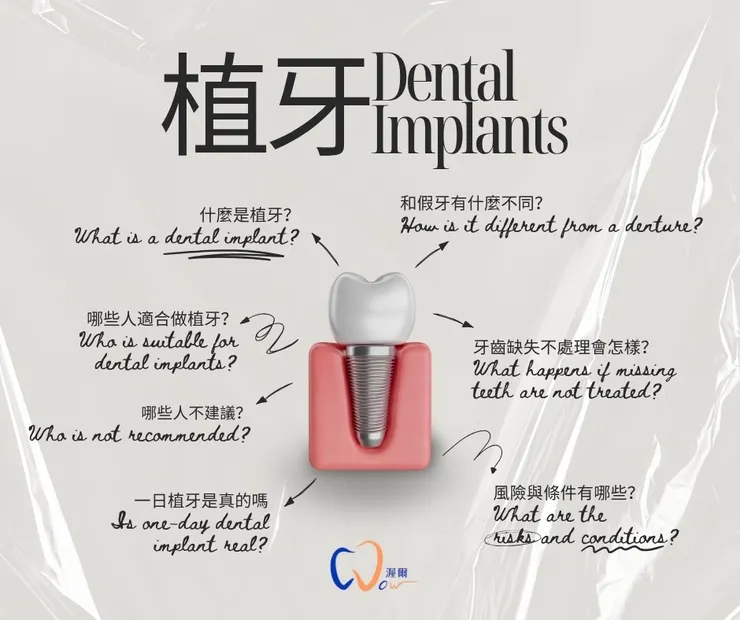 【植牙全解析】缺牙不只是美觀問題！你一定要知道的7件事！