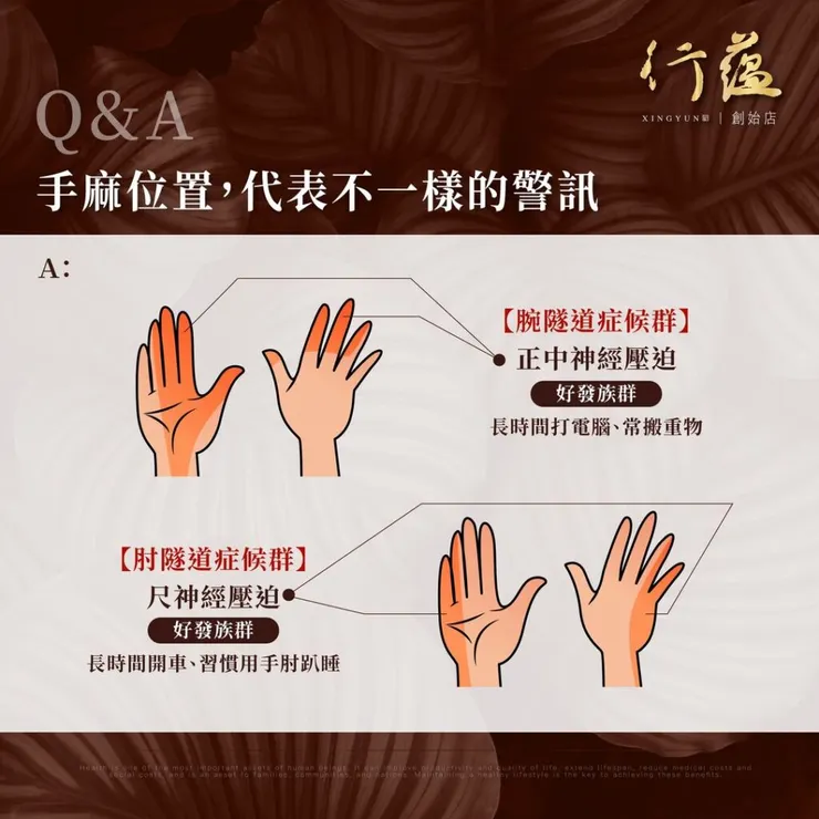 行蘊QA｜手麻位置代表不一樣的警訊