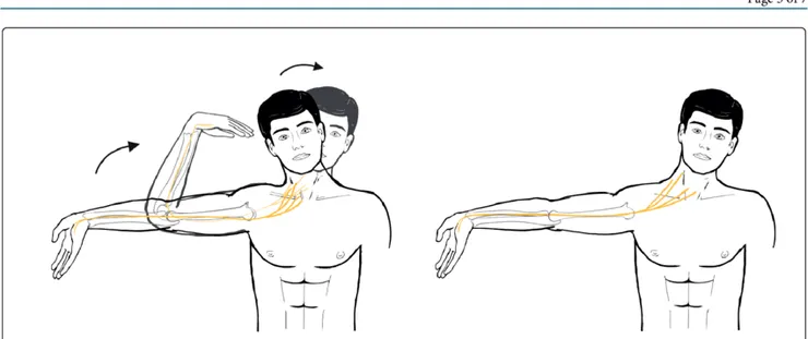 正中神經鬆動居家復健動作