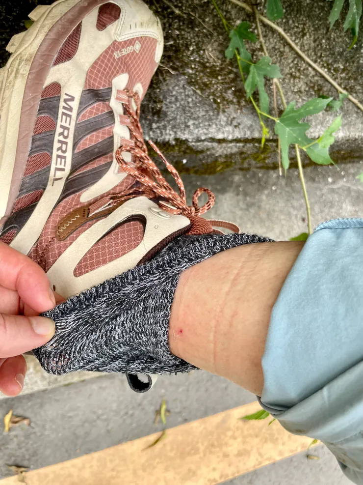 2025-0509-在望古嶺腳森療場勘，野狗穿透厚襪的咬痕