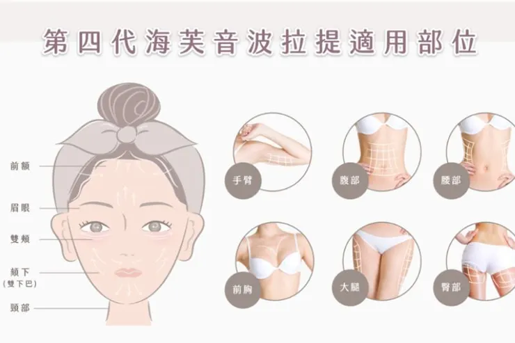 海芙音波媚必提適用於以下人群