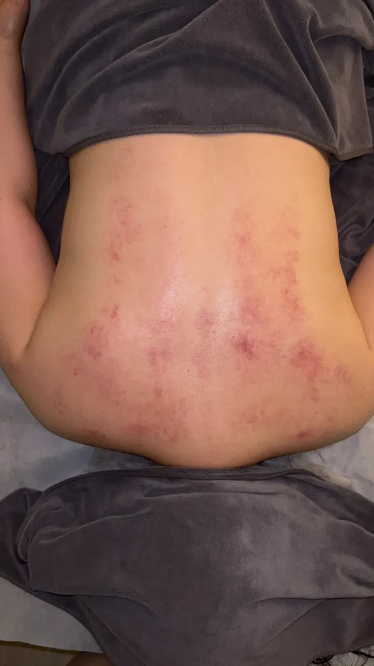 揣息·Tranquil｜溫罐後的身體情況