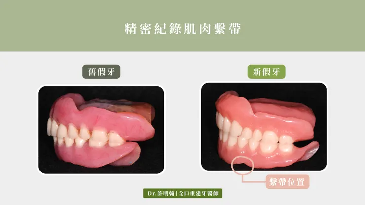 精密紀錄肌肉繫帶