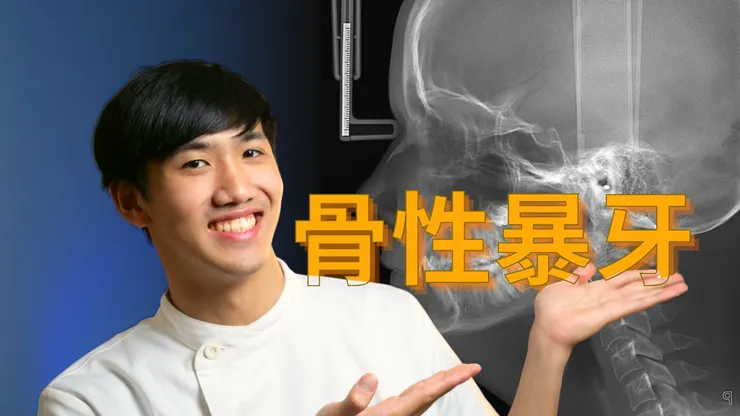 【骨性暴牙是什麼？】不是每個暴牙都能靠牙齒矯正解決！
