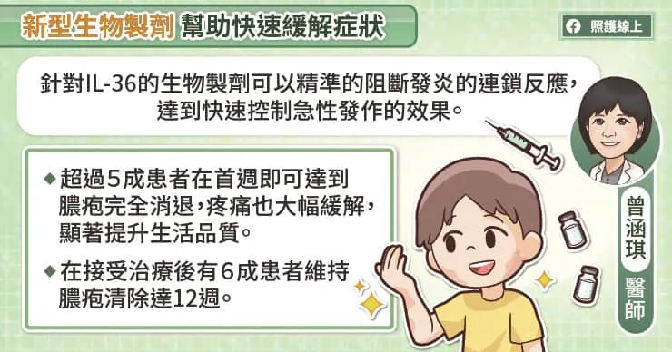 新型生物製劑幫助快速緩解症狀
