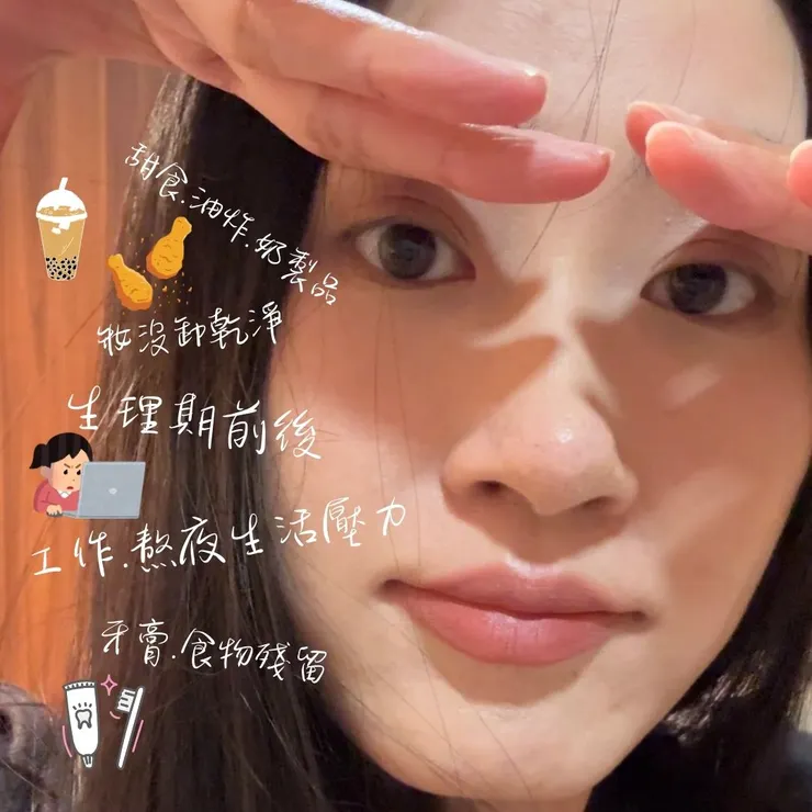 下巴痘背後的秘密，中醫到從西醫的解讀