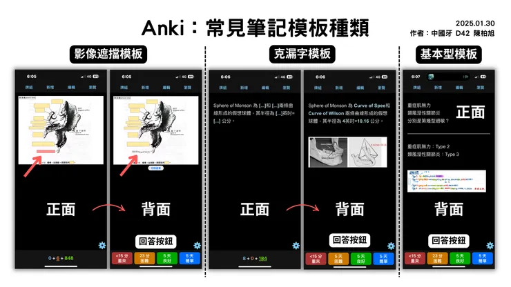 常見筆記類型(內建於 Anki,經過我小修改,需下載我的單字卡才能得到)