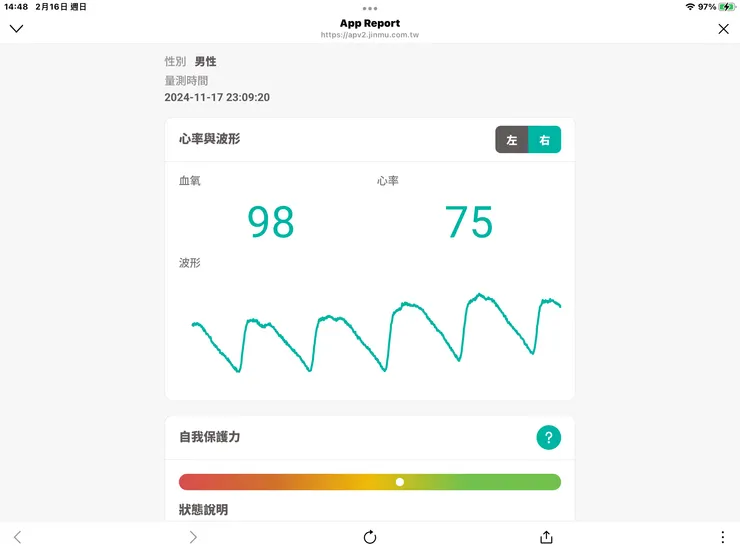圖一：返法後林大哥左右類似的心波形