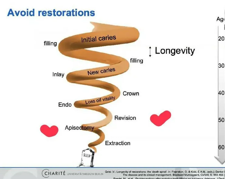傳統主流醫學治療下牙齒的一生