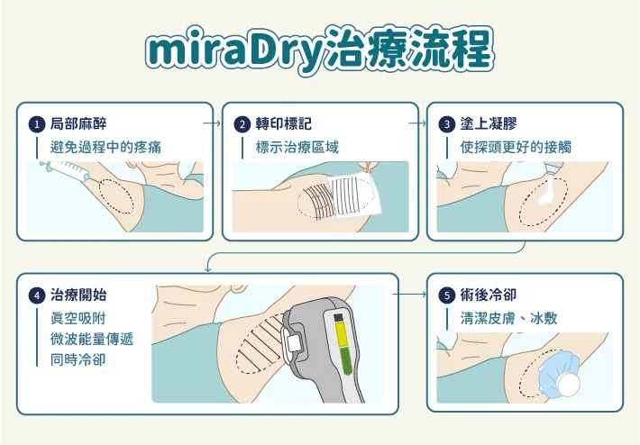 miraDry清新微波治療過程