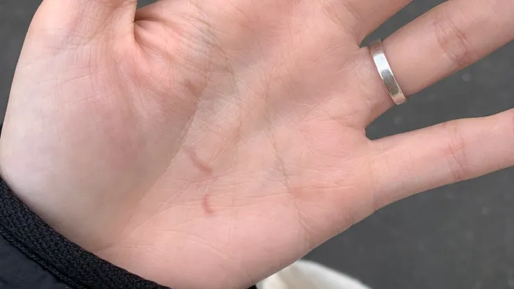 握拳握到甲痕一直到傍晚才消失XD