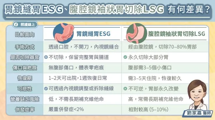 胃鏡縫胃ESG、腹腔鏡袖狀胃切除手術LSG有何差異？