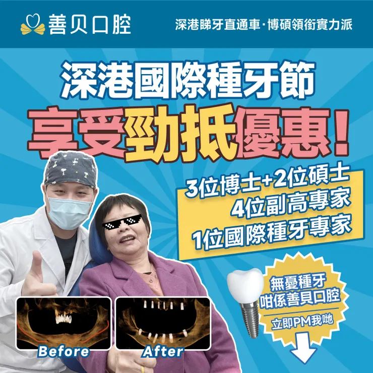 深圳善貝口腔國際種牙節啟動，進口種植牙39980蚊，WhatsApp了解更多：+852 5194 6662