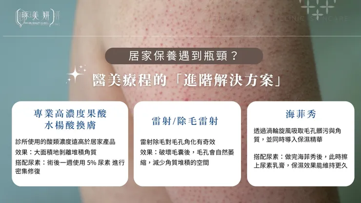 告別粗糙雞皮與乾裂！尿素乳膏搭配居家酸類換膚+醫美療程，找回消失已久的滑嫩感！