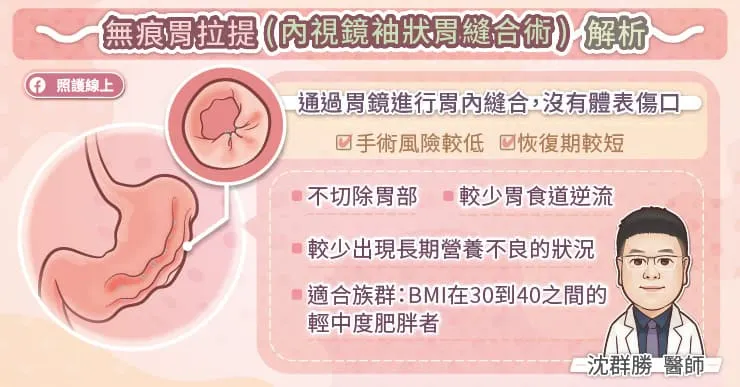 無痕胃拉提(內視鏡袖狀胃縫合術）