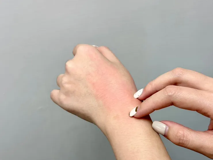 圖說:換季時期,乾燥氣候常引起泛紅、乾癢等肌膚不適。(圖/ Neogence霓淨思)