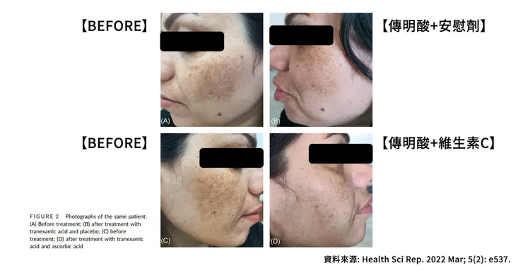 維生素c怎麼搭配?