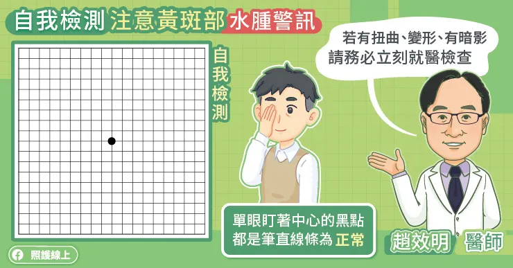 自我檢測注意黃斑部水腫警訊