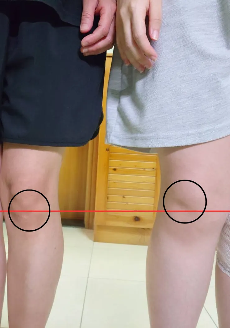 左側是我媽的膝蓋,右側是我的膝蓋