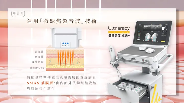 不只拉提，還更準！美國音波二代 Ultherapy PRIME即時影像系統，為什麼效果更有感？
