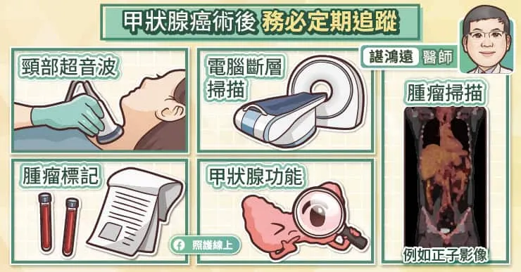 甲狀腺癌術後定期追蹤