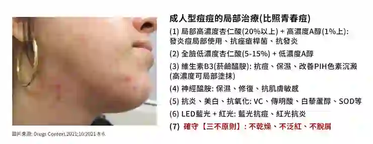 悶痘長不停怎麼辦?