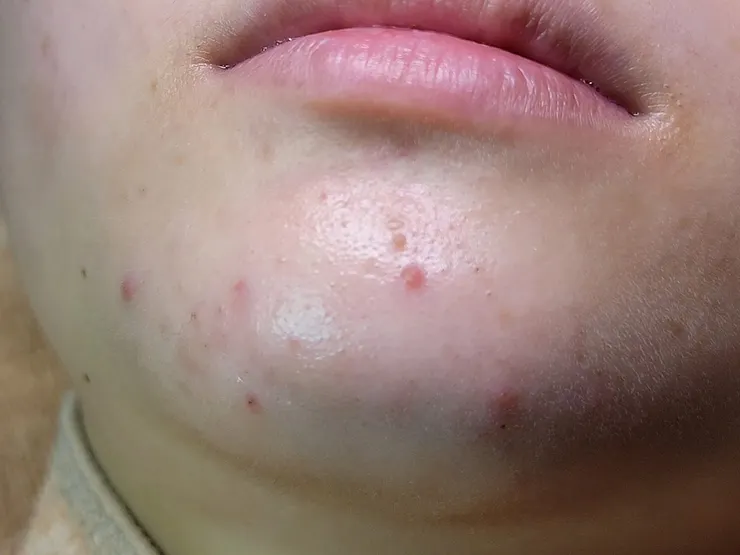 台南做臉推薦~聖誕跨年美美玩!水水臉蛋兒交給FILF小資美顏