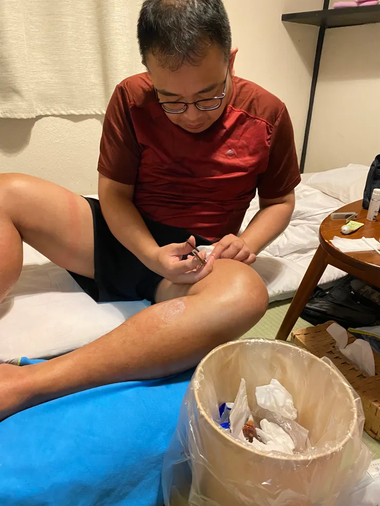 我們因為運動服裝太緊繃結果長水泡，一開始跟民宿借到消毒水但沒有藥。後來回到市區一點的勝浦才在超商買到藥