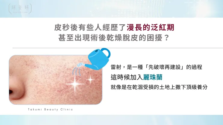 皮秒雷射後必加「麗珠蘭」？終結暗沉、修復屏障，打造無瑕水光肌的黃金組合！