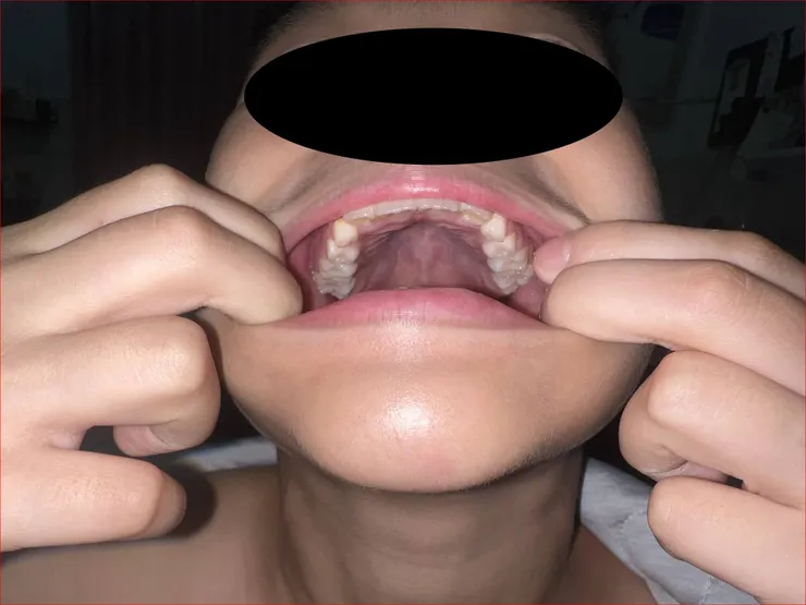 頭仰，張大嘴，照上面