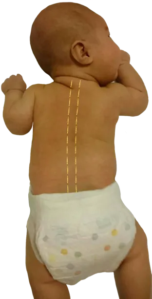 愛兒寶：華佗小兒夾脊穴