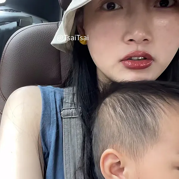 脂漏性皮膚炎保養推薦-肌密青春原液