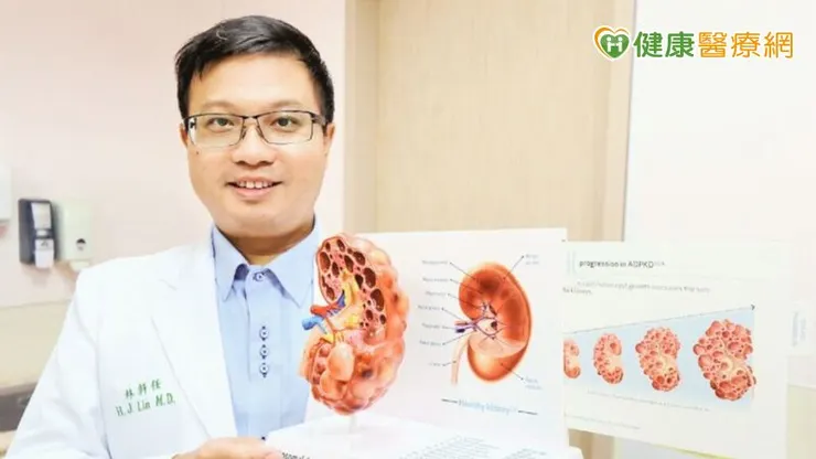 多囊腎是由基因變異導致腎臟產生大量囊泡（水泡），這些囊泡不斷生長會壓迫並取代正常的腎元組織，最終導致腎衰竭需要終身洗腎或換腎。