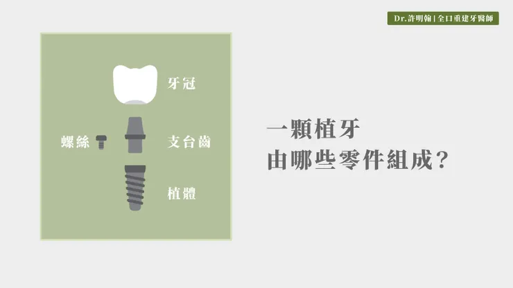 植牙結構 一顆植牙由哪些部分組成