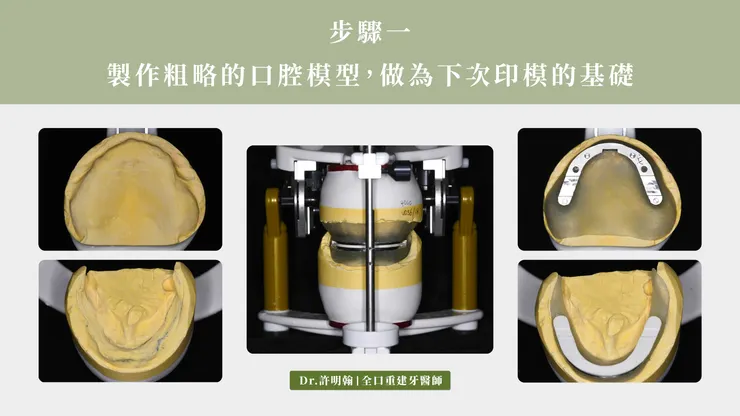 步驟一 製作粗略的口腔模型 做為下次印模的基礎