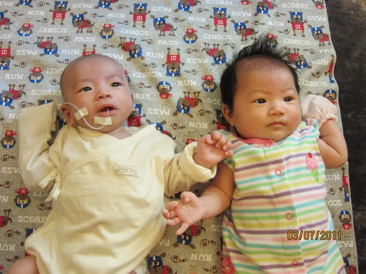 多了一條管子會讓你對這個孩子帶有異樣眼光嗎？