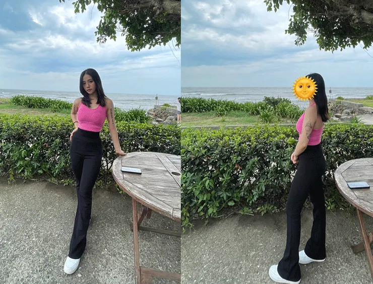 抽脂補胸 術後兩個月