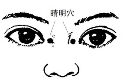睛明穴