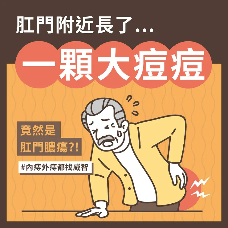 令人坐立難安的肛門膿瘍是甚麼？如何避免？