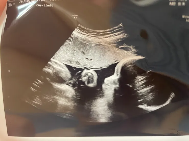 Ching的寶寶32週超音波照