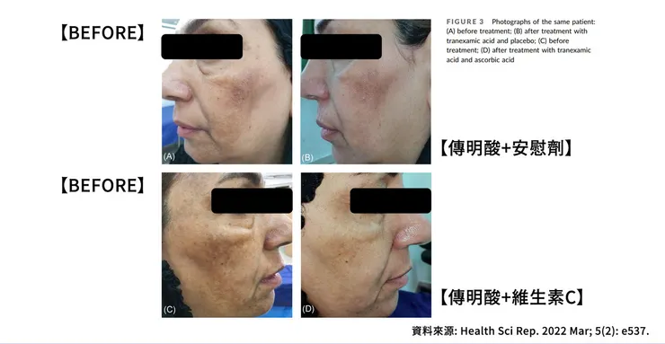 維生素c怎麼搭配?