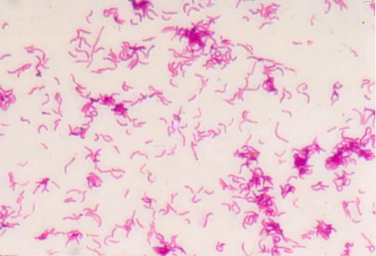 幽門螺旋桿菌 革蘭氏染色顯微鏡照